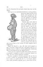 [Cas de disproportion physiologique considérable du corps d'un foetus avec celui de sa mère. Naine d [...]