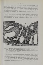 Fig. 4. - Muqueuse utérine d'une lapine à grossesse unilatérale expérimentale, 25e jour de la grosse [...]