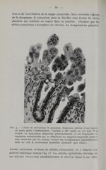 Fig. 5. - Chute du syncytium de grossesse - Titres et travaux scientifiques de Marc Klein, assistant [...]