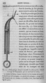 Fig. 17. Tube-seringue destiné à recueillir les salives pures - Leçons de physiologie expérimentale  [...]