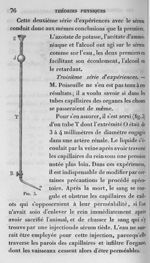 Fig. 3. Expérience sur l'écoulement des liquides [tube] - Cours de médecine du Collège de France : L [...]