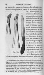 Fig. 5. Instruments pour pratiquer l'ouverture du canal vertébral - Cours de médecine du Collège de  [...]