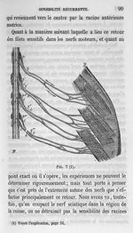 Fig. 7 - Cours de médecine du Collège de France : Leçons sur la physiologie et la pathologie du syst [...]