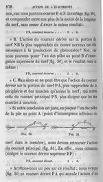 Fig. 30 et 31 - Cours de médecine du Collège de France : Leçons sur la physiologie et la pathologie  [...]