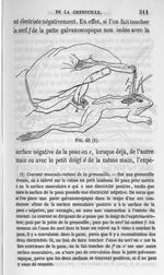 Fig. 45. Courant musculo-cutané de la grenouille - Cours de médecine du Collège de France : Leçons s [...]