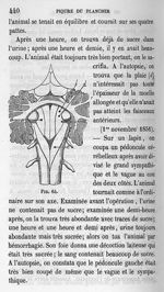 Fig. 64 - Cours de médecine du Collège de France : Leçons sur la physiologie et la pathologie du sys [...]