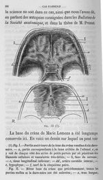Fig. 10 - Cours de médecine du Collège de France : Leçons sur la physiologie et la pathologie du sys [...]