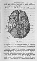 Fig. 11 - Cours de médecine du Collège de France : Leçons sur la physiologie et la pathologie du sys [...]