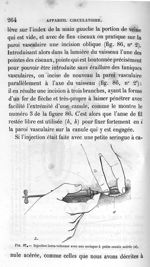 Fig. 87. Injection intra-veineuse avec une seringue à petite canule acérée - Leçons de la physiologi [...]