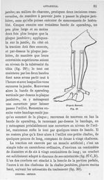 Fig. 29. [Positionnement de l'appareil de Barwell sur la jambe] - Leçons cliniques sur la chirurgie  [...]