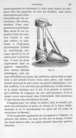 Fig. 31. [Soulier orthopédique pour pied bot] - Leçons cliniques sur la chirurgie orthopédique 