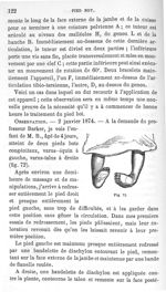 Fig. 72. [Deux pieds bots congénitaux, varus-équin et varus-talus] - Leçons cliniques sur la chirurg [...]