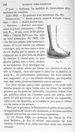 Fig. 94. [Arthrite tibio-tarsienne guérie] - Leçons cliniques sur la chirurgie orthopédique 