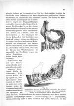 Fig. 28. Sagittalschnitt durch den Alveolarfortsatz beider Kiefer. Man übersicht das Verhalten der A [...]