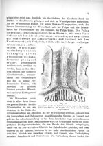 Fig. 33. Querschnitt durch ein Zahnfleischseptum sammt den nachbarlichen zwei Zähnen. Die Papillen s [...]