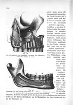 Fig. 45. Das Nervengeflecht des Oberkiefers. Die Zahn- und Zahnfleischnerven sind deutlich zu sehen  [...]