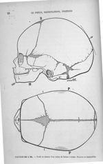 Figures 23 et 24 - Profil et dessus d'un crâne de foetus à terme. Sutures et fontanelles - Introduct [...]