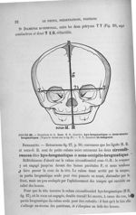 Figure 29 - Diamètres de la face ... - Introduction à l'étude clinique et à la pratique des accouche [...]