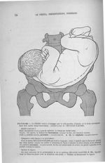 Figure 44 - Le tronc tend à s'engager par le côté gauche; l'épaule et le bras correspondant font sai [...]
