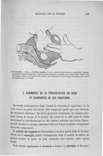 Figure 116 - Face ... - Introduction à l'étude clinique et à la pratique des accouchements. Anatomie [...]