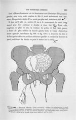 Figure 183 - Epaule droite, ... - Introduction à l'étude clinique et à la pratique des accouchements [...]