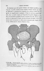 Figure 184 - Epaule droite, ... - Introduction à l'étude clinique et à la pratique des accouchements [...]