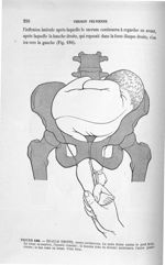 Figure 186 - Epaule droite, ... - Introduction à l'étude clinique et à la pratique des accouchements [...]