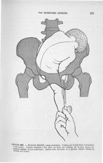 Figure 187 - Epaule droite, ... - Introduction à l'étude clinique et à la pratique des accouchements [...]