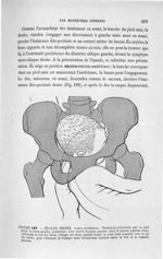 Figure 189 - Epaule droite, ... - Introduction à l'étude clinique et à la pratique des accouchements [...]