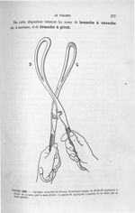 Figure 236 - Les deux branches du forceps désarticulé ... - Introduction à l'étude clinique et à la  [...]