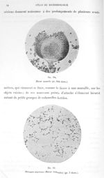 Fig. 10. Mucor mucedo (gr. 160 diam.) / Fig. 11. Rhizopus nigricans (mucor stolonifer) (gr. 3 diam.) [...]