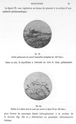 Fig. 33. Alvéole pulmonaire du canard (aspergillus fumigatus) (gr. 250 diam.) / Fig. 34. Surface de  [...]