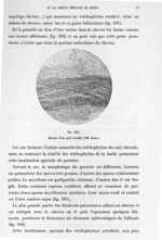 Fig. 102. Racine d'un poil envahi (180 diam.). - Atlas de microbiologie par E. Doyen et G. Roussel e [...]