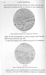 Fig. 103. Spores mycéliennes nucléées d'un trichophyton ectothrix (gr. 1000 diam.) / Fig. 104. Epide [...]