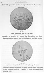 Fig. 133. Culture trichophytique adulte (gr. 250 diam.) / Fig. 134. Spores accessoires, portées dire [...]