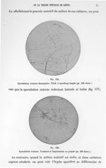 Fig. 135. Sporulation externe disséminée. Trich. à mycélium fragile (gr. 300 diam.) / Fig. 136. Spor [...]