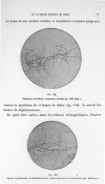 Fig. 142. Filaments mycéliens terminaux stériles (gr. 200 diam.) / Fig. 143. Spores mycéliennes de d [...]