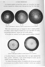Fig. 157 / Fig. 158 / Fig. 159. Cultures du microsporum audouïni sur gélose au moût de bière, 2, 3 e [...]