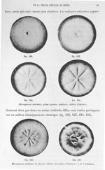 Fig. 162 / Fig. 163 / Fig. 164 / Fig. 165. Microsporum audouïni, gélose peptone maltosée, milieu d'é [...]