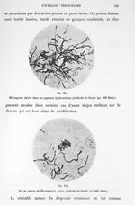 Fig. 214. Microsporon furfur dans les squames épidermiques (méthode de Gram) (gr. 500 diam.) / Fig.  [...]