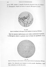 Fig. 216. Spores et mycéliums du microsporon furfur (méthode de Gram) (gr. 500 diam.) / Fig. 217. Sp [...]