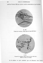 Fig. 239. Fusisporium moschatum. Culture âgée de 2 jours (400 diam.) / Fig. 240. Fusisporium moschat [...]