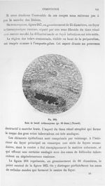 Fig. 264. Rein de bœuf. Actinomycose (gr. 60 diam.) (Nocard). - Atlas de microbiologie par E. Doyen  [...]