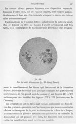 Fig. 266. Rein de bœuf. Actinomycose (gr. 300 diam.) (Nocard). - Atlas de microbiologie par E. Doyen [...]