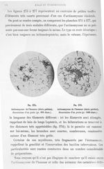 Fig. 275. Actinomycose de l'homme (abcès pelvien), dissociation d'un grain (gr. 800 diam.) / Fig. 27 [...]
