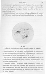 Fig. 277. Actinomycose de l'homme (abcès pelvien), dissociation d'un grain (gr. 1000 diam.). - Atlas [...]