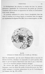 Fig. 281. Actinomycose de l'homme. Culture dans le bouillon (gr. 1000 diam.). - Atlas de microbiolog [...]