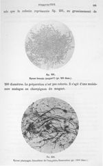 Fig. 291. Mycose buccale (muguet ?) (gr. 200 diam.) / Fig. 292. Mycose pharyngée. Concrétion de l'am [...]