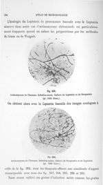 Fig. 293. Actinomycose de l'homme. Infection mixte. Culture de leptotrix (gr. 1000 diam.) / Fig. 294 [...]