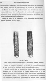 Fig. 307 et 307 bis. Farcin du bœuf. Cultures sur gélose âgées de 5 mois (Nocard) (grandeur naturell [...]
